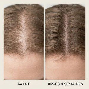 Rituel Chevelure de Reine : Cure Anti-Chute & Pousse (Sans Sulfates)