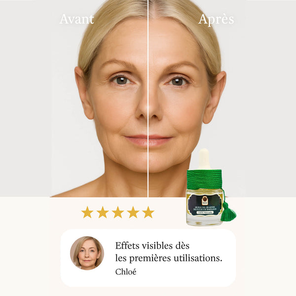 L’Huile Anti-Âge Naturelle N°1 – Figue de Barbarie Bio & Pure