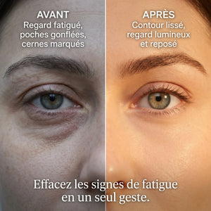 Anti-Dark Circle Cream