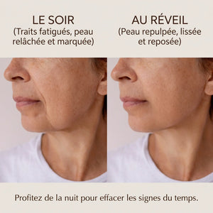 Avant après crème de nuit anti-âge argan figue de barbarie peau régénérée