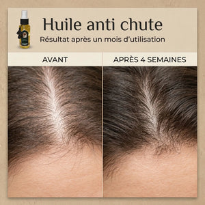 Huile Anti-Chute Naturelle – Stimulation & Croissance des Cheveux