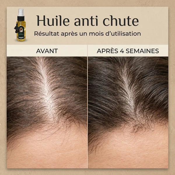 Huile Anti-Chute Naturelle – Stimulation & Croissance des Cheveux