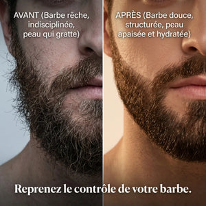 Huile de Barbe Naturelle & Bio 30ml – Pousse, Douceur et Hydratation