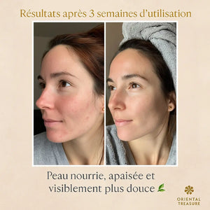 Savon naturel au lait de chamelle – Répare et apaise la peau
