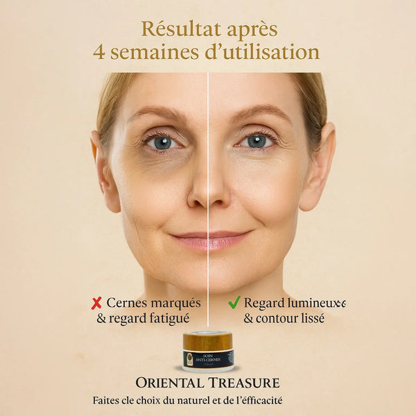 Creme gegen Augenringe